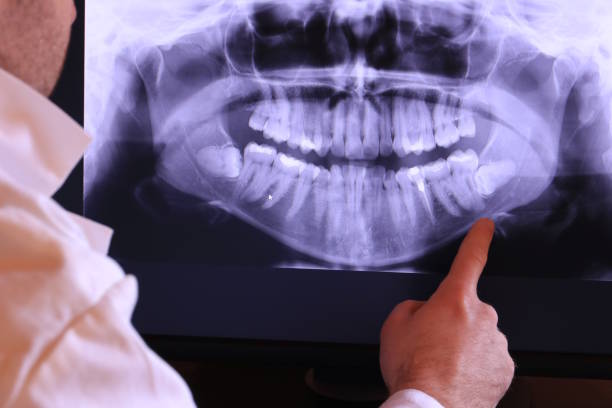 Best Walk-In Emergency Dentist in North Lakeville, MA
