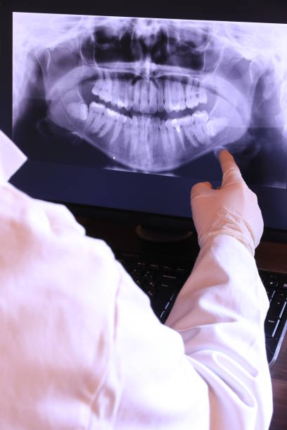 Best Emergency Root Canal Treatment in North Lakeville, MA